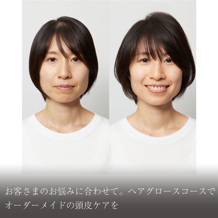 オーダーメイドの施術、ヘアグロースコースでオーダーメイドの頭皮ケアを